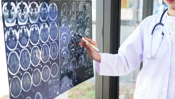 Whole-Body MRI Scans on Multiple Myeloma Patients Can Detect Tiny Traces of Cancer in the Bone Marrow – ICR
