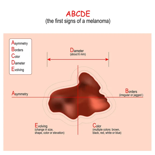 Total Body Photography and Automated Lesion Mapping: The Next Stage in Skin Cancer Surveillance 5 skin cancer prevention, total body photography