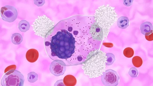 MRD-Guided Strategy in Myeloma – International Society of Liquid Biopsy