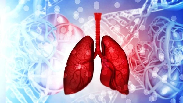 A Simple Guide on Lung Cancer Screening by The SOLACE Project