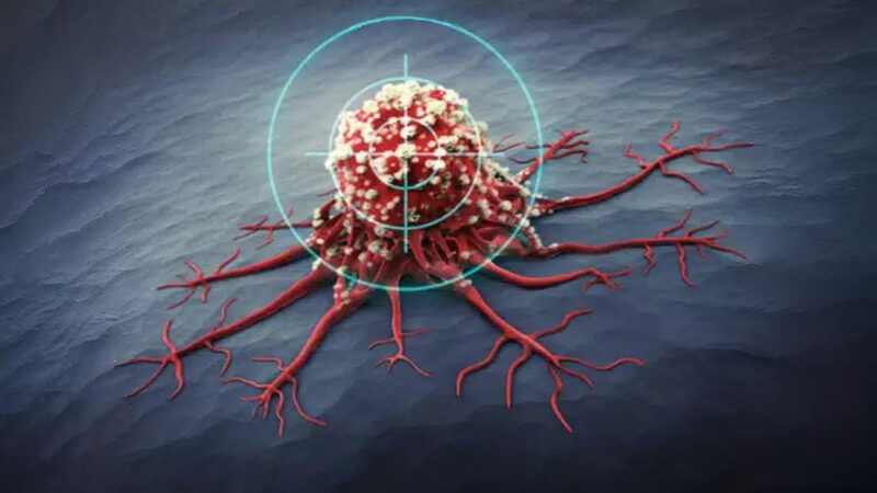 Expanding Access to Advanced Solid Tumour Trials in Asia-Pacific: ASTER Study