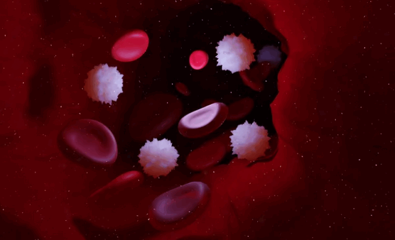 “Lineage Switch” in Acute Leukemia After Targeted Immunotherapy – NCI Center for Cancer Research