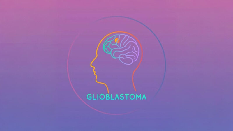 Anthony R. Sloan: Estrogen-Dependent Platelet PAR4 Signaling Shapes Immunity in Glioblastoma