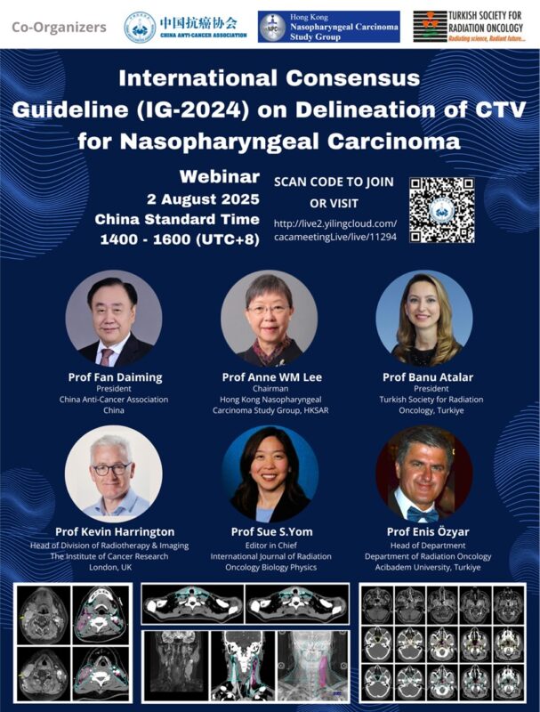 International Consensus Guideline on Delineation of CTV for Nasopharyngeal Carcinoma