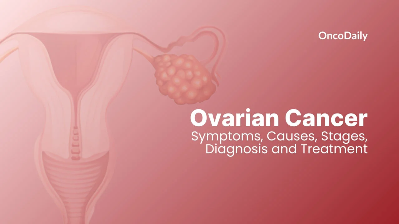 ovarian cancer