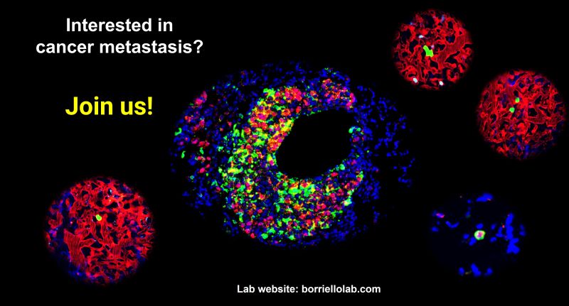 Lucia Borriello: Uncovering the Secrets of Tumor Dormancy and Metastasis