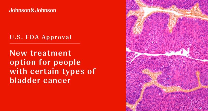 Bladder Cancer