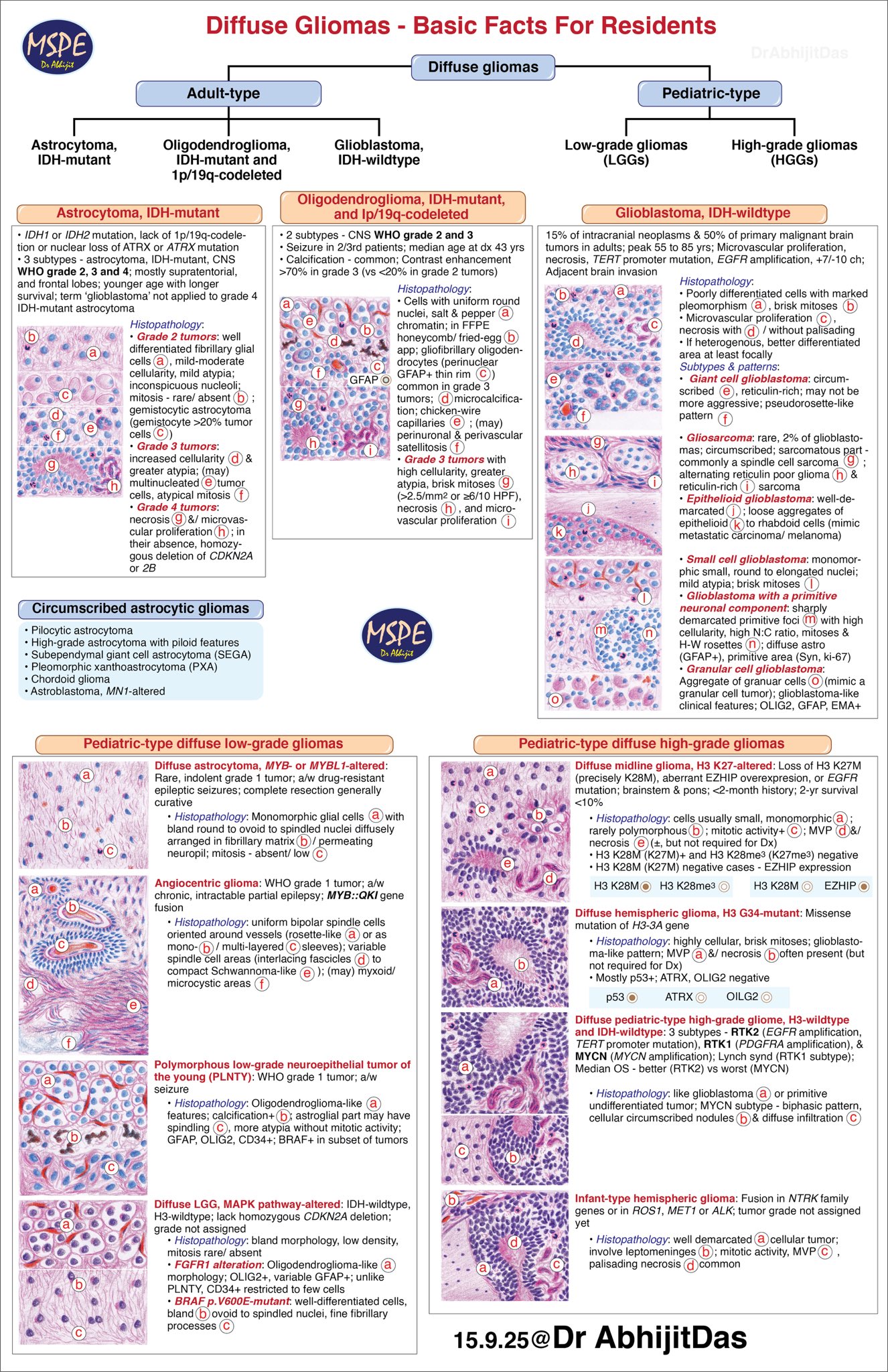 Abhijit Das: Basic Facts For Residents About Diffuse Gliomas - OncoDaily