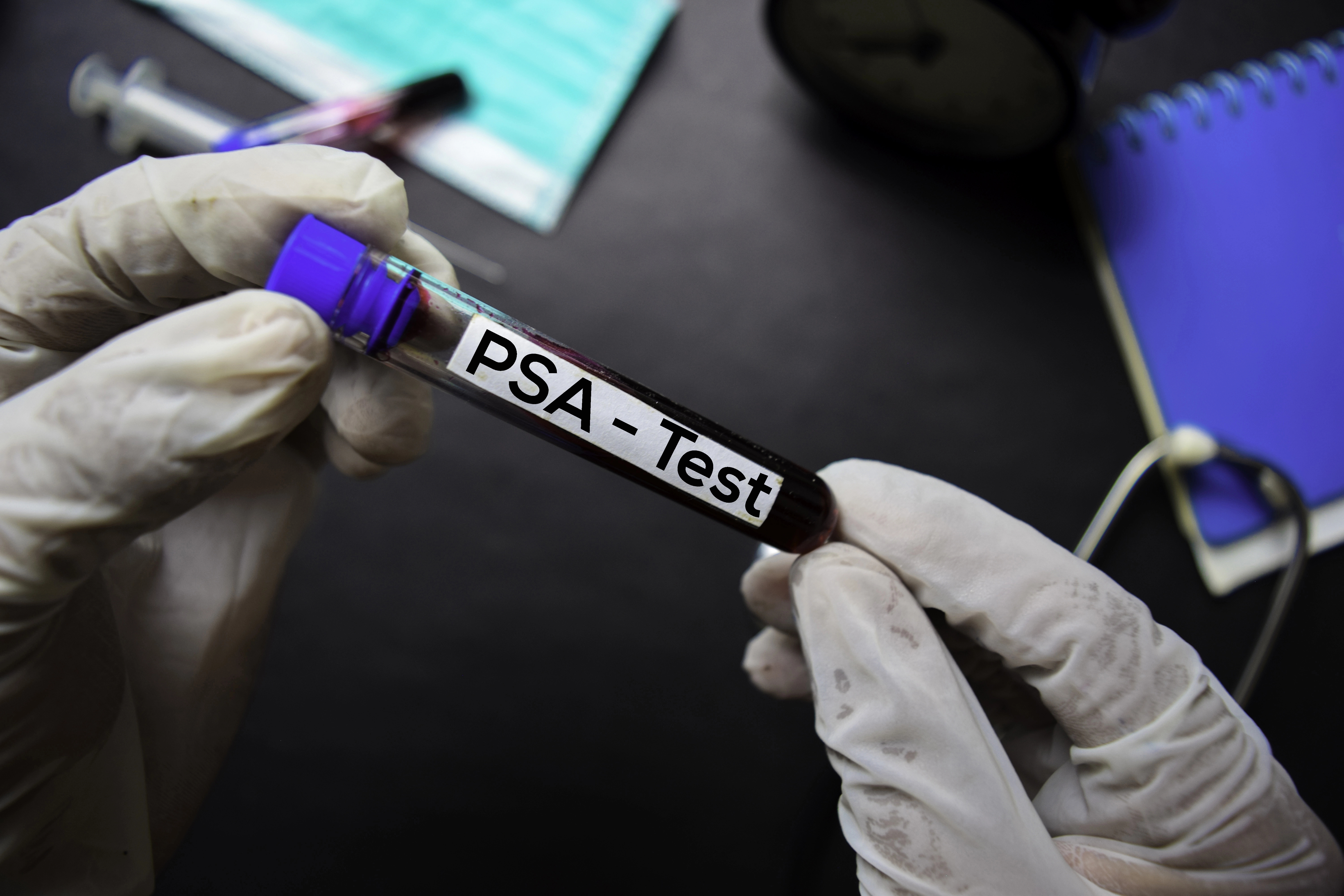 Prostate Cancer in Korea