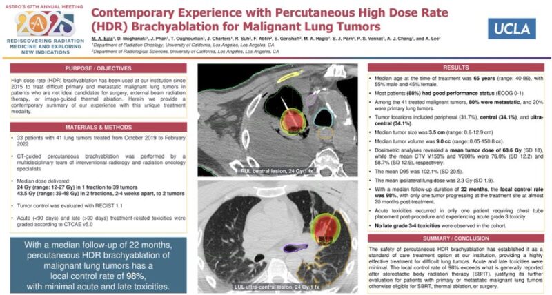 Drew Moghanaki: The Outcomes Following HDR Brachyablation for Lung Tumors at ASTRO25
