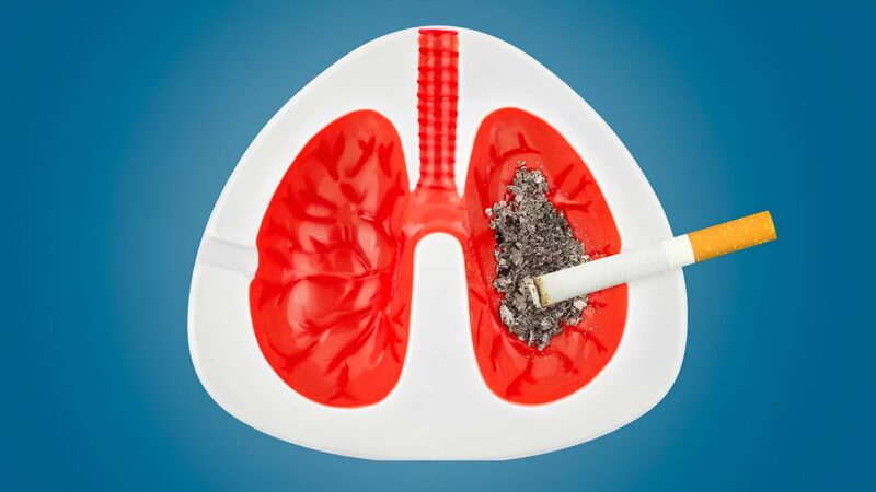 ACS NLCRT Strategic Plan: Tobacco Treatment in the Context of Lung Cancer Screening
