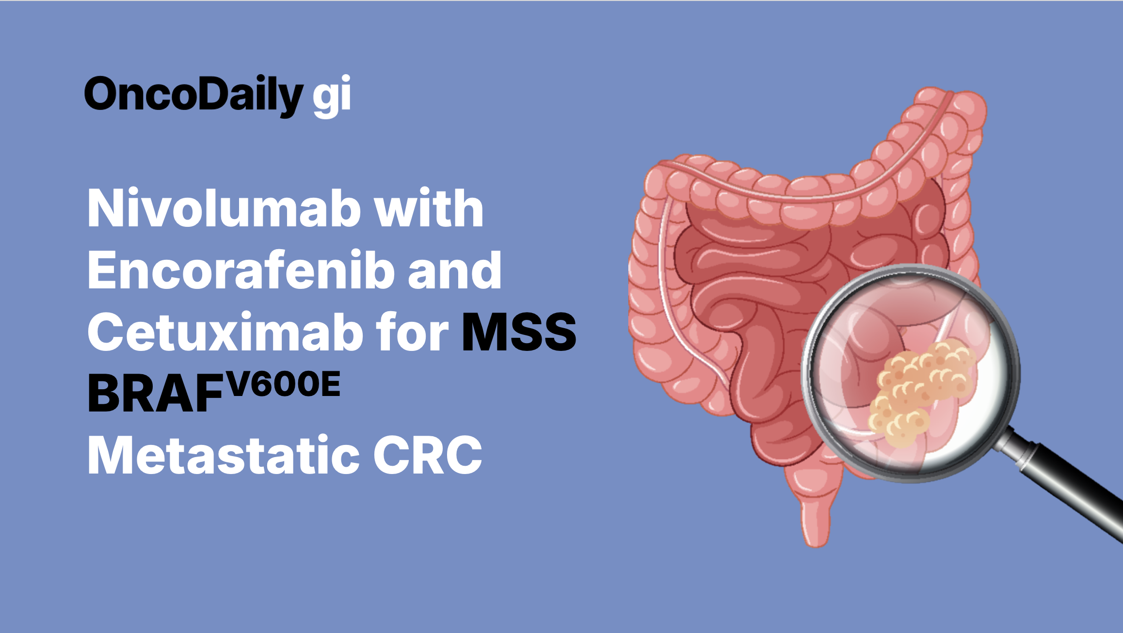 nivolumab encorafenib cetuximab for brafv600e MSS CRC