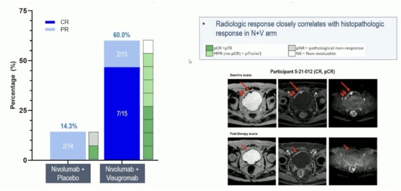 GDFather-NEO Trial at ESMO 2025