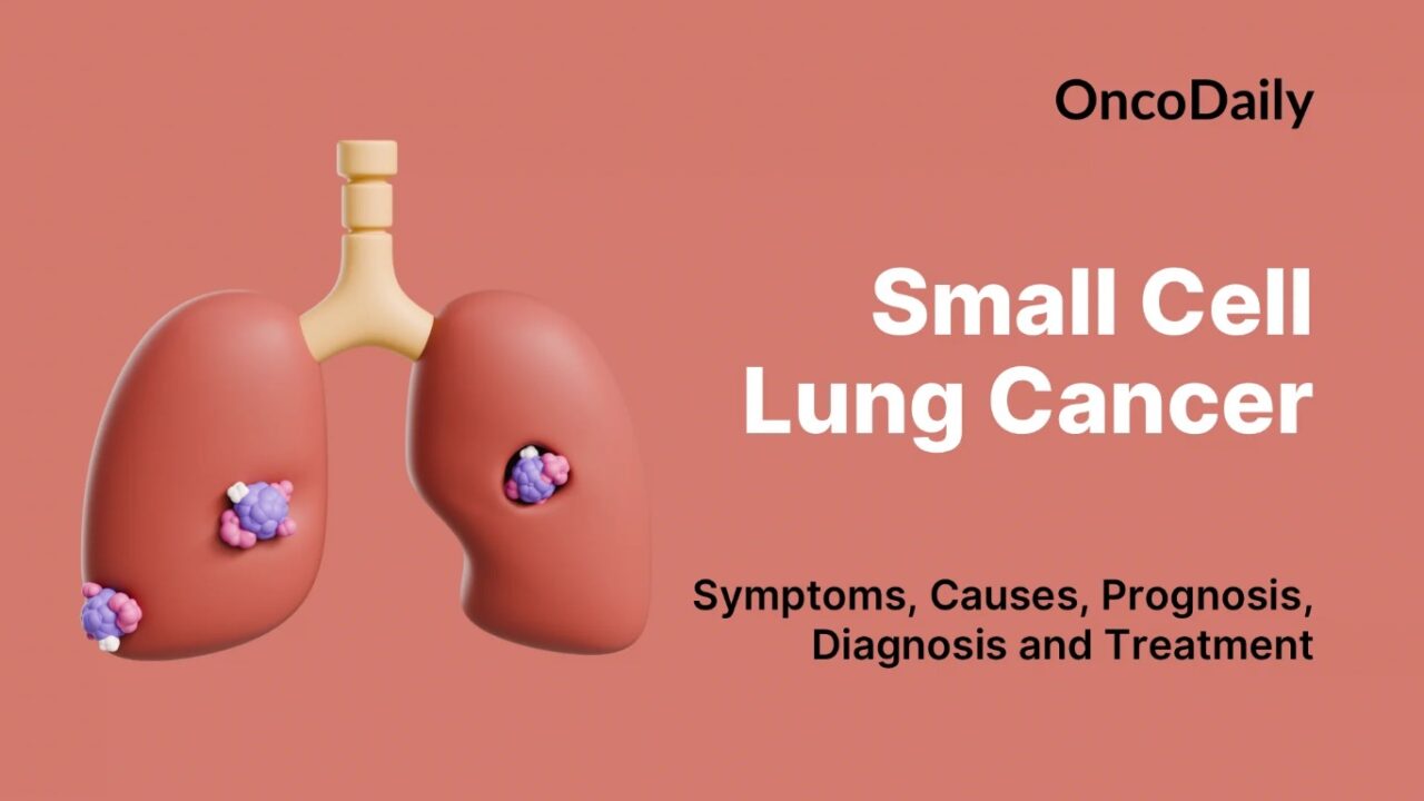 Success Rate of Chemotherapy for Lung Cancer: What Patients Need to ...
