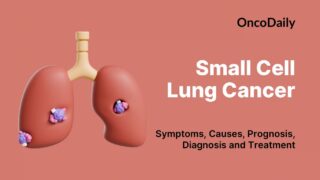 Success Rate of Chemotherapy for Lung Cancer: What Patients Need to ...