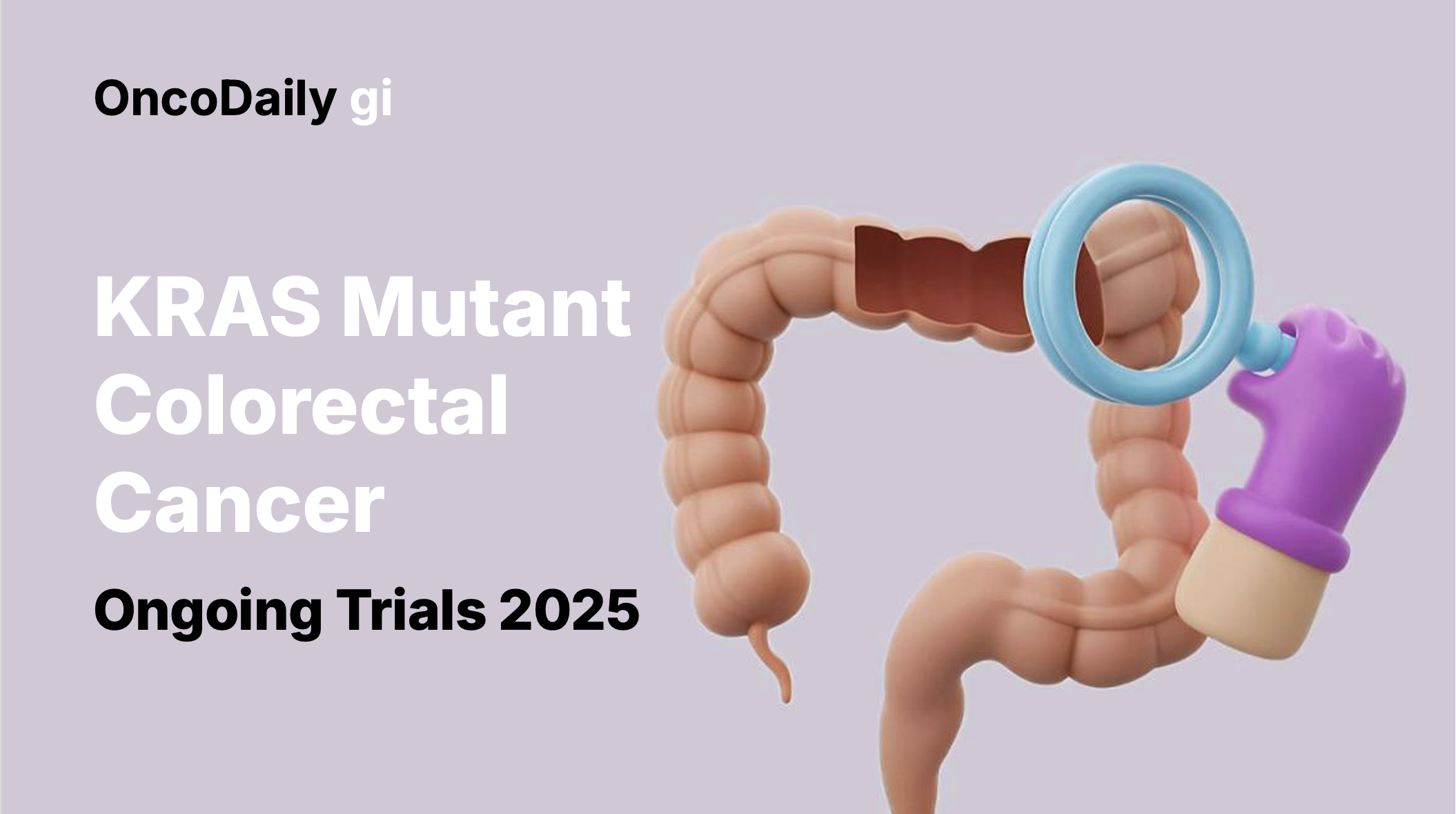 KRAS colorectal cancer ongoing trials 2025