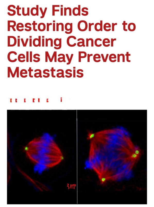 Triple-Negative Breast Cancer 