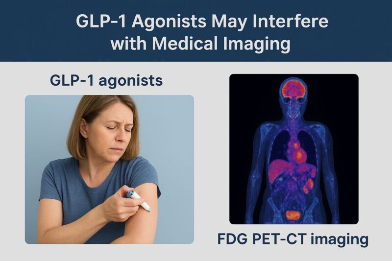 GLP-1 Agonists