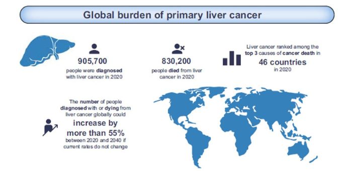 Liver Cancer global burden