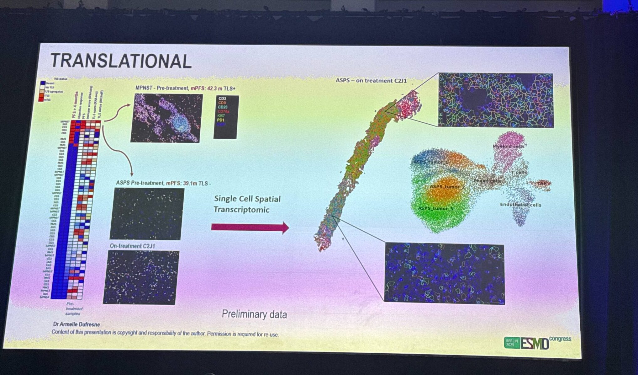 COTESARC Trial at ESMO 2025: MEK + PD-L1 Blockade in Advanced STS (Phase I–II) 4 cotesarc translational