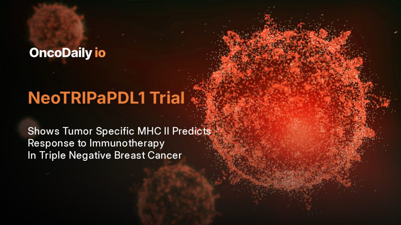 Tumor-Specific MHC-II Predicts Immunotherapy Response in Triple-Negative Breast Cancer