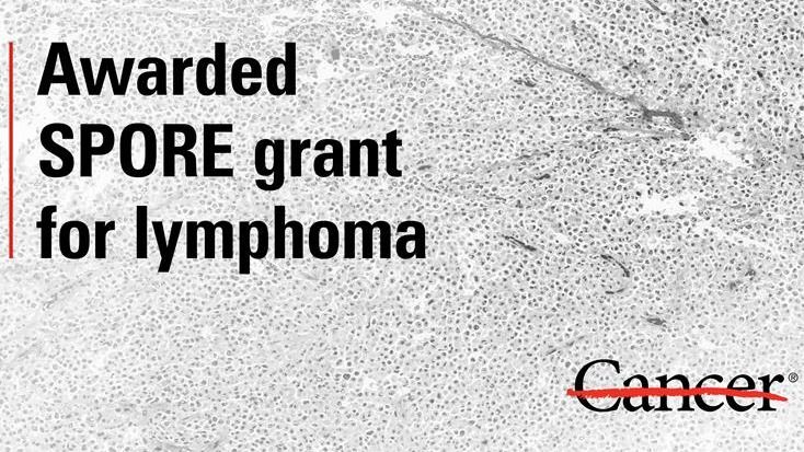 MD Anderson Cancer Center Receives $12 million SPORE Grant For Lymphoma