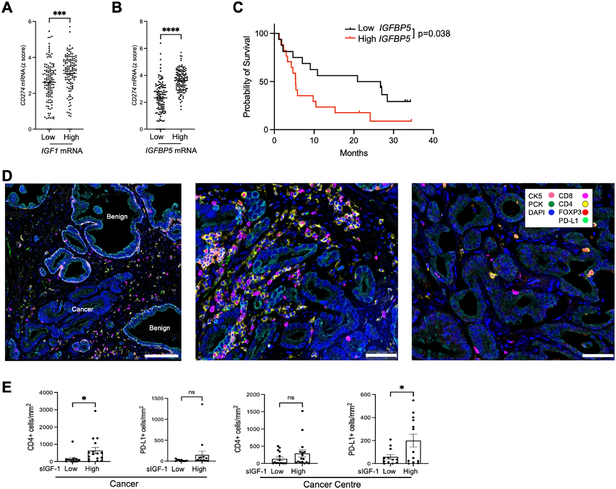IGF-1 Regulates Cancer Cell Immune Evasion in Prostate Cancer 3 IGF-1
