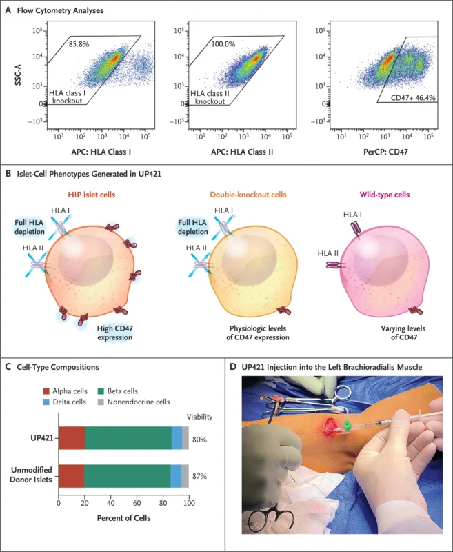 CRISPR-Edited Islet Transplant