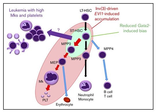 Sanam Loghavi: Raising Awareness of Aggressive AML with Chromosome 3 Inversion