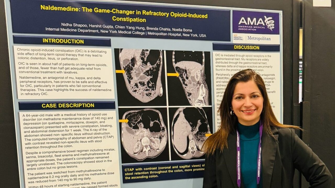 Nidha Iqbal Shapoo: Naldemedine Can Be a Life Saver