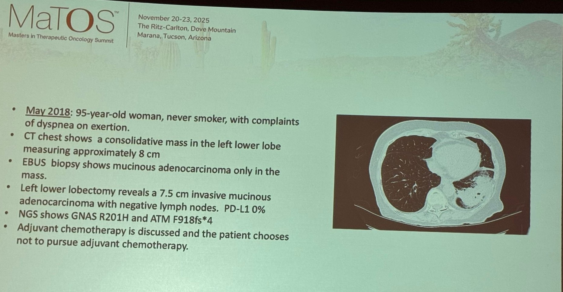 Estela Rodriguez: Most Provoking Case Presentation by Jorge Gomez at MaTOS 2025