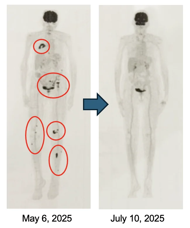 Patrick Soon-Shiong: The Overlooked Immune Failure Driving Cancer Mortality - A Clinical Blind Spot 11 Patrick Soon-Shiong
