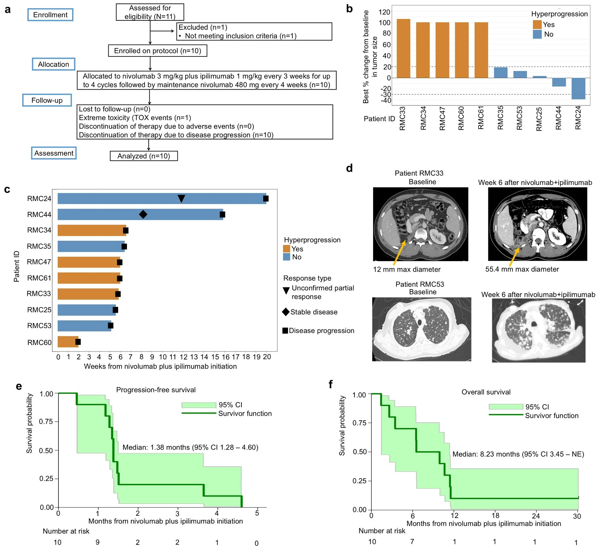 Pavlos Msaouel: First-Ever Dedicated Clinical Trial for Renal Medullary Carcinoma