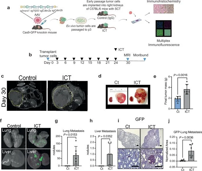 Pavlos Msaouel: First-Ever Dedicated Clinical Trial for Renal Medullary Carcinoma