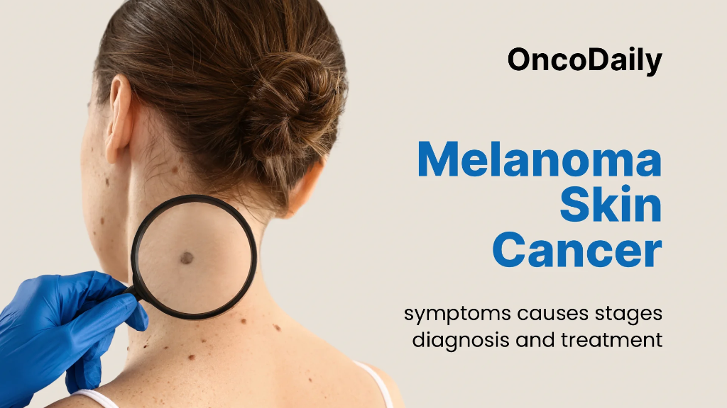 Melanoma Cure Rate: What Patients Need to Know in 2025 2 Melanoma Cure Rate