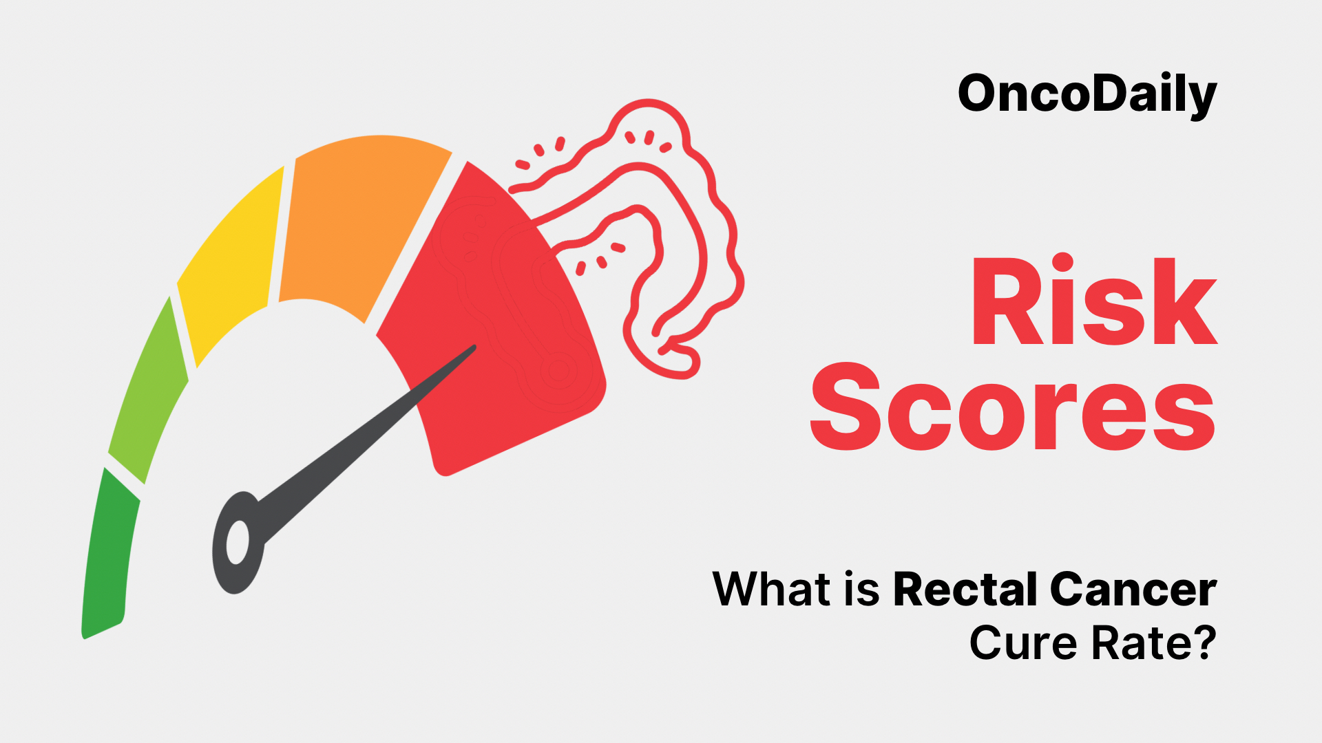 Rectal Cancer Cure Rate: What Patients Need to Know 2025