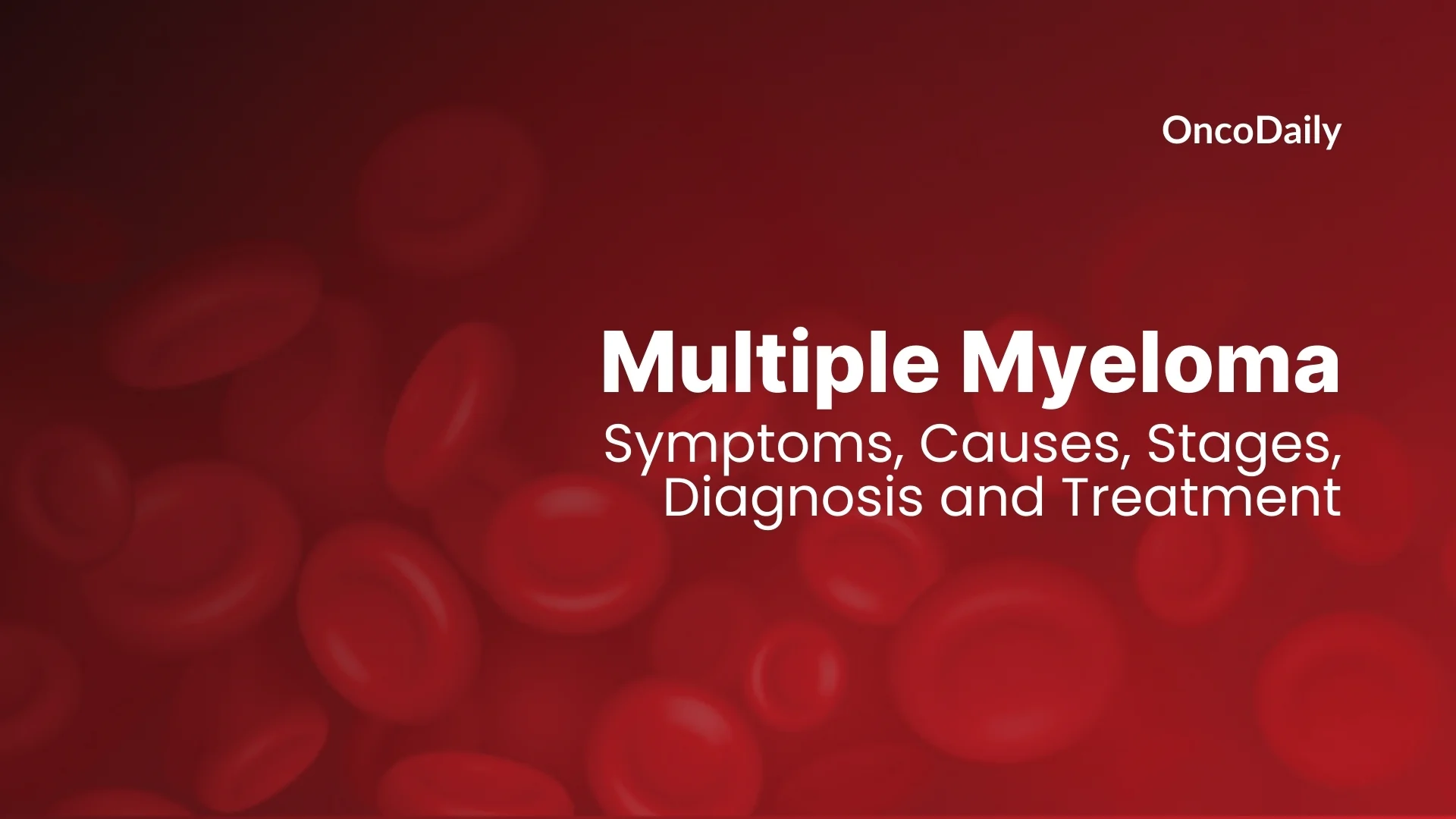 FDA Approves Daratumumab and Hyaluronidase-fihj for High-Risk Smoldering Multiple Myeloma 2 Daratumumab