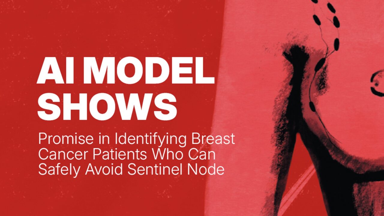AI Model Shows Promise in Helping Over 40% of Breast Cancer Patients Avoid Sentinel Node Biopsy – CancerWorld