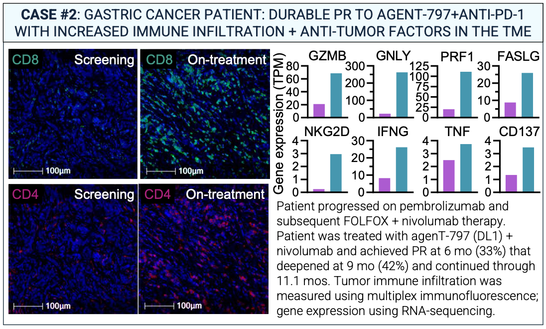 gastric cancer agent797 mink inkt cell