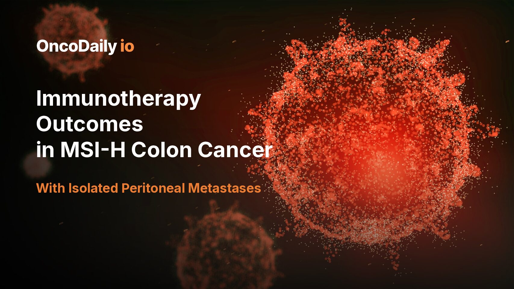 Immunotherapy Improves Survival in MSI-H Colon Cancer with Isolated Peritoneal Metastases
