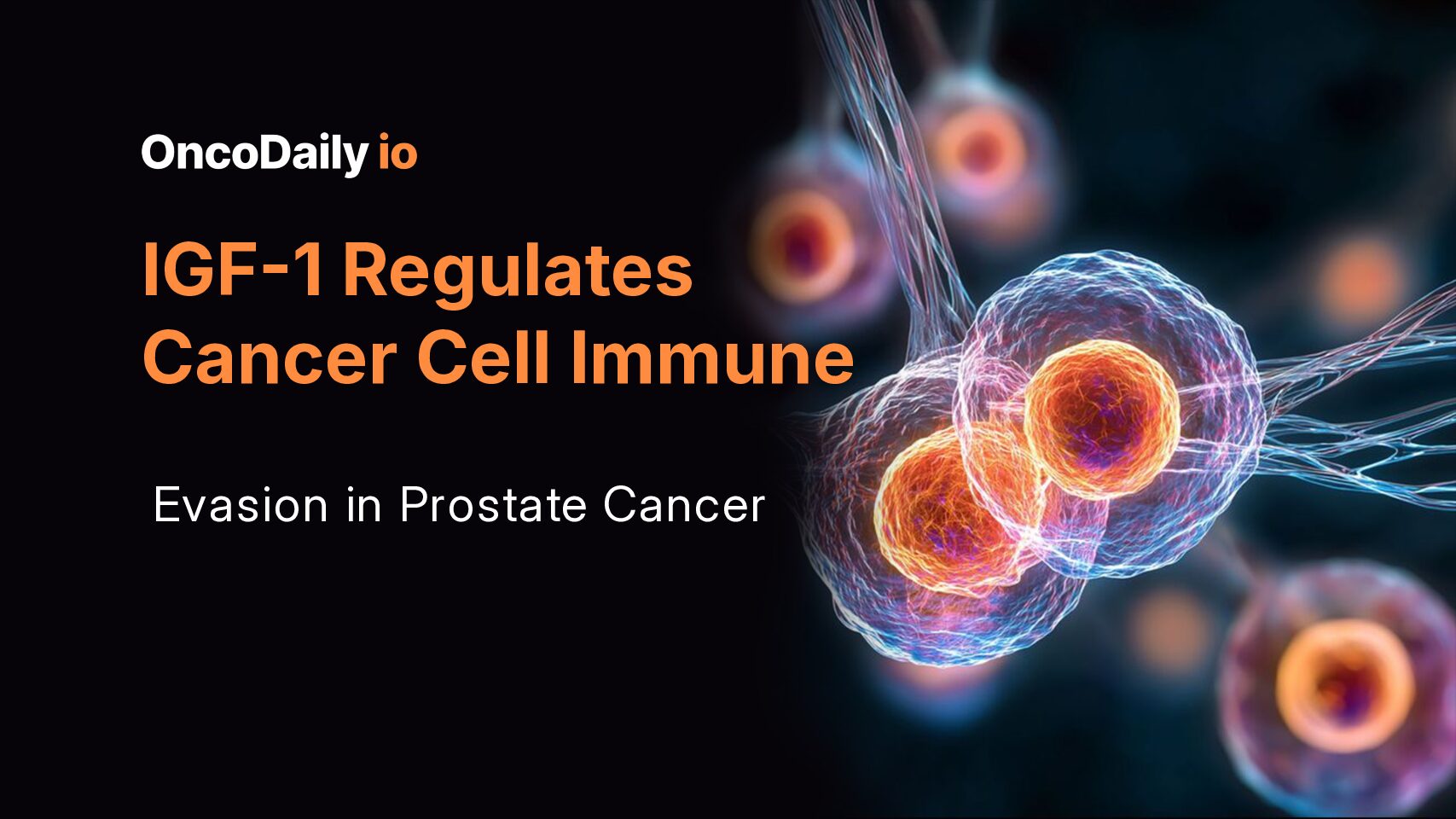 IGF-1 Regulates Cancer Cell Immune Evasion in Prostate Cancer