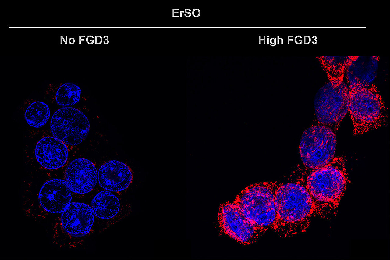 FGD3 as a Critical Modulator of Chemotherapy and Immunotherapy Response in Breast Cancer 3 FGD3