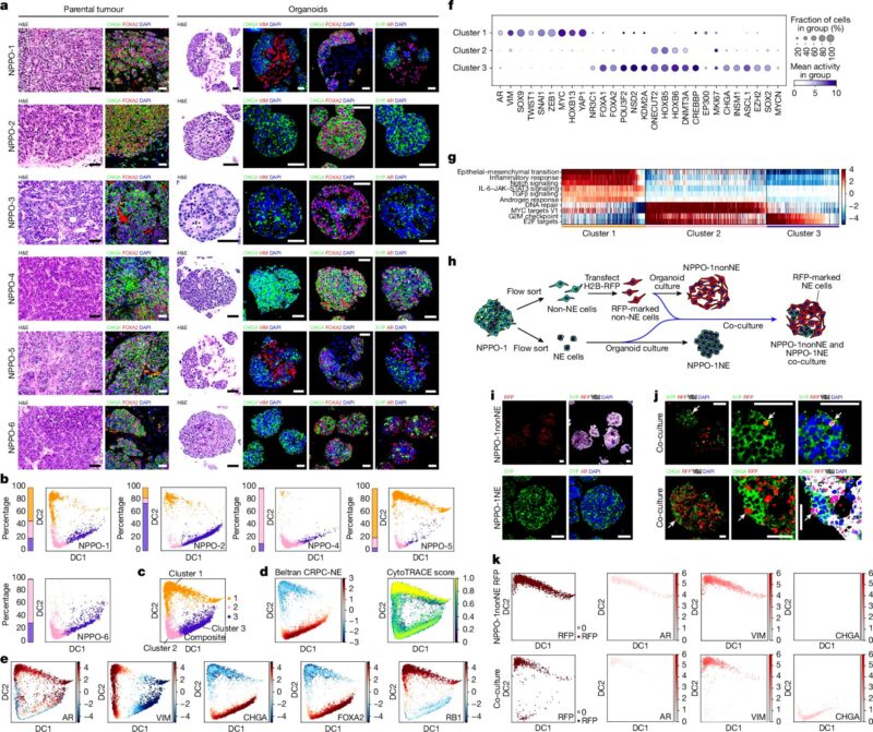 Terrence Connolly: NSD2 as a Target in Treatment-Resistant Prostate Cancer 2 Terrence Connolly: NSD2 as a Target in Treatment-Resistant Prostate Cancer