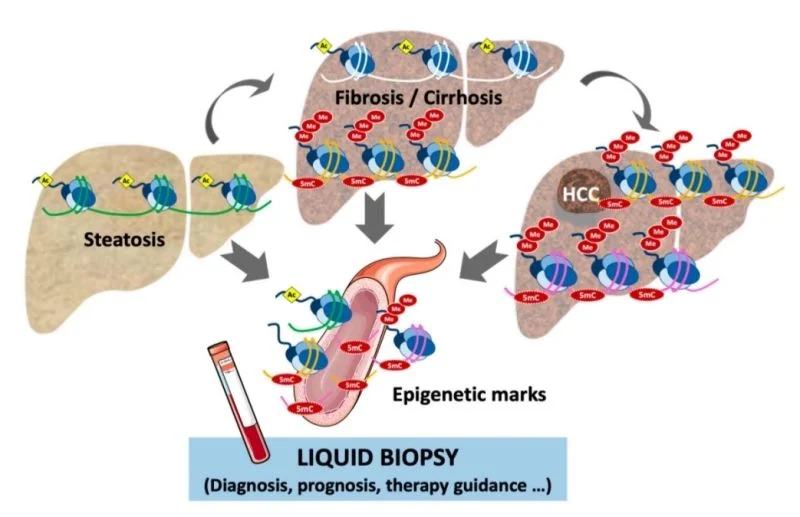Achyut Saroj: How Methylation Is Rewriting the Rules of Liquid Biopsy in Solid Tumors