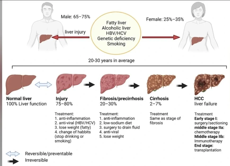 Achyut Saroj: What Gastritis Taught me About Liver Cancer?