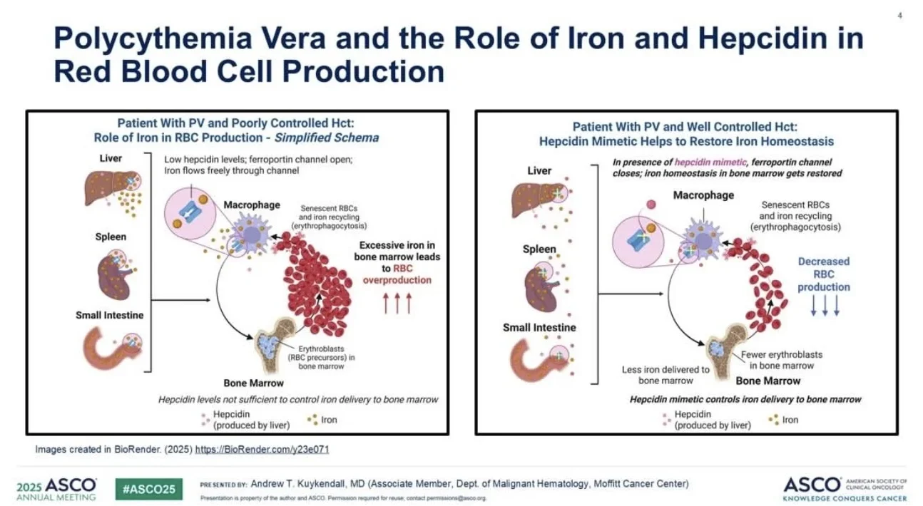 Talha Badar: Leukemia and Myeloid Diseases - Highlights of 2025