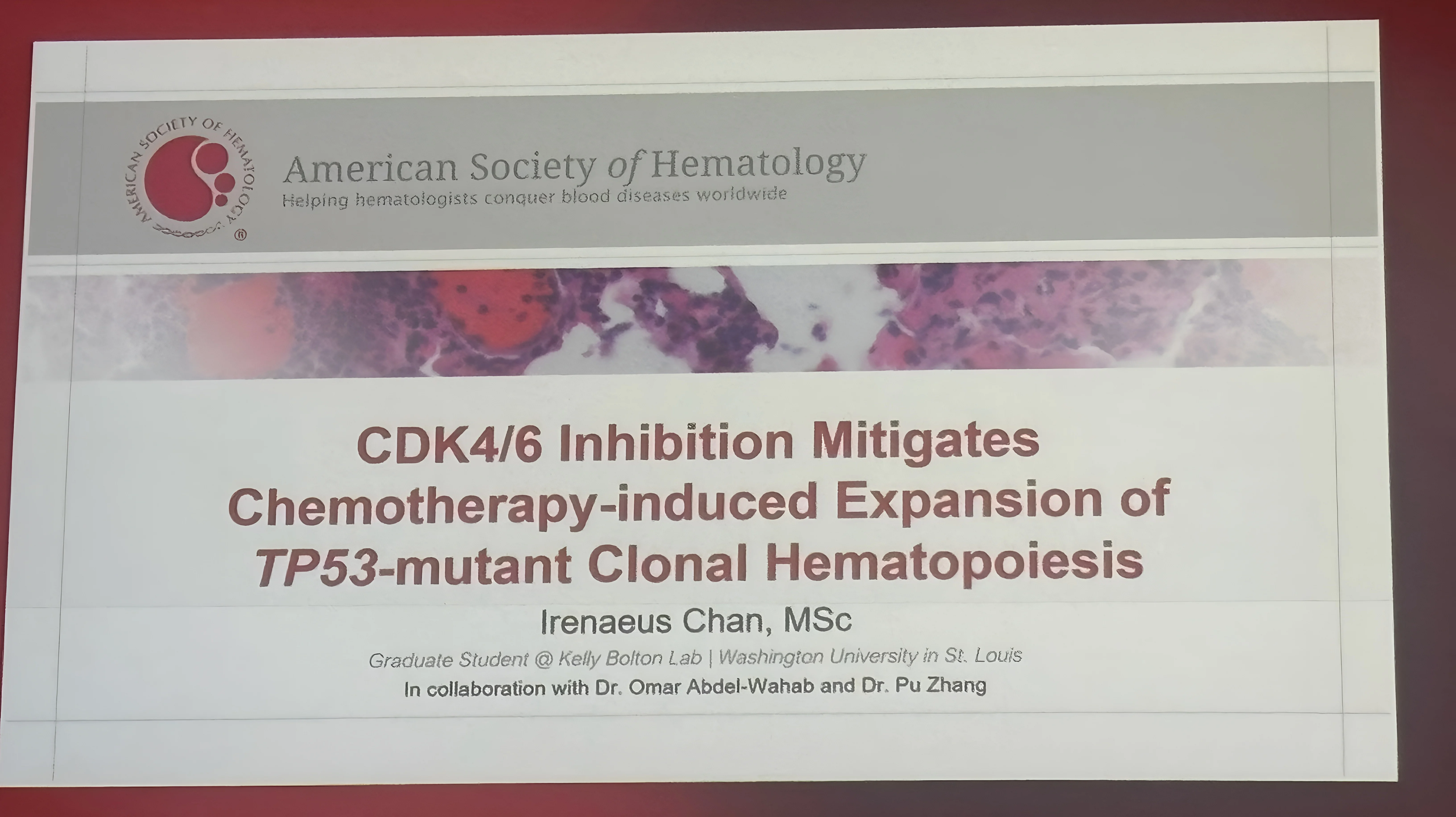 Yazan Madanat: Kelly Bolton Delivers ASH25 Plenary on Therapy-Related Myeloid Neoplasms 2 Yazan Madanat: Kelly Bolton Delivers ASH25 Plenary on Therapy-Related Myeloid Neoplasms