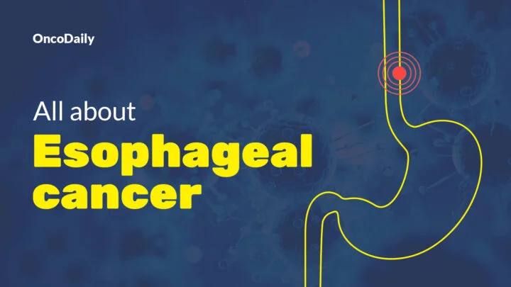 Esophageal cancer