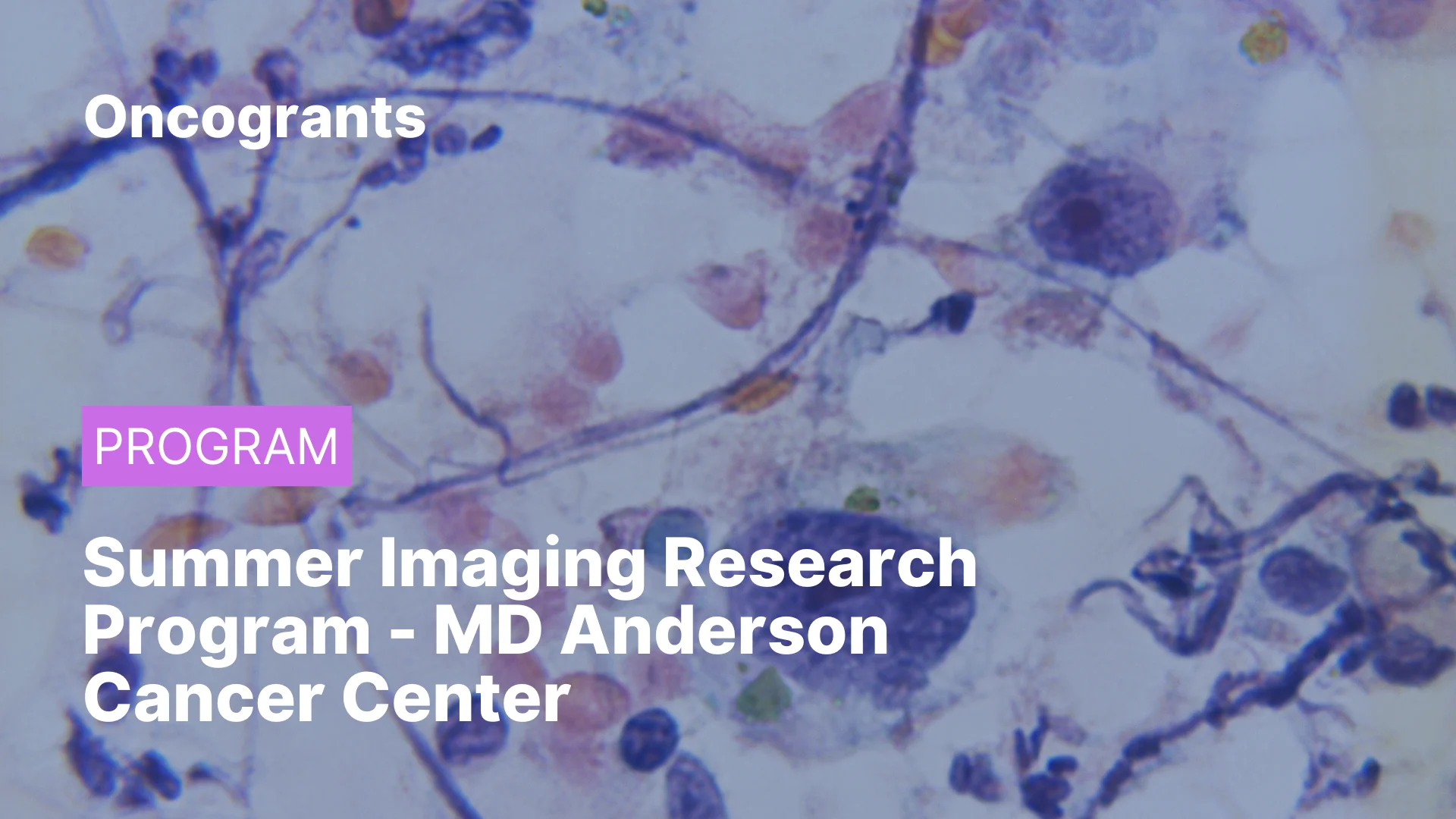 Summer Imaging Research Program - MD Anderson Cancer Center