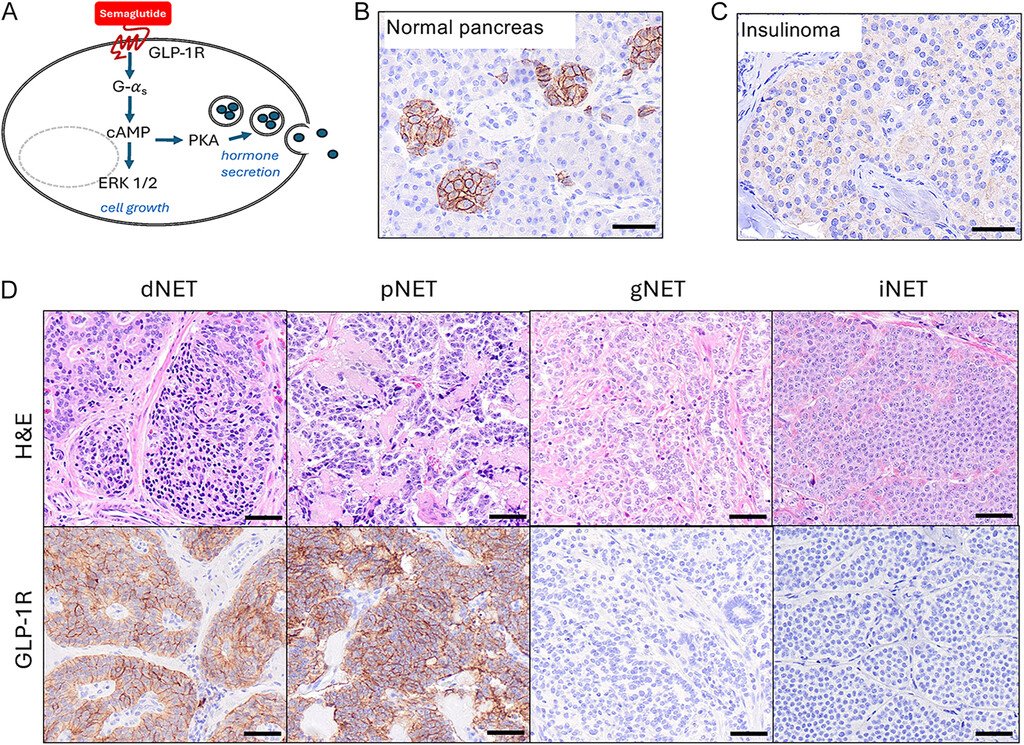 Anirban Maitra: New Insights on GLP-1